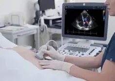 Ecocardiograma en CEIC Villarrica